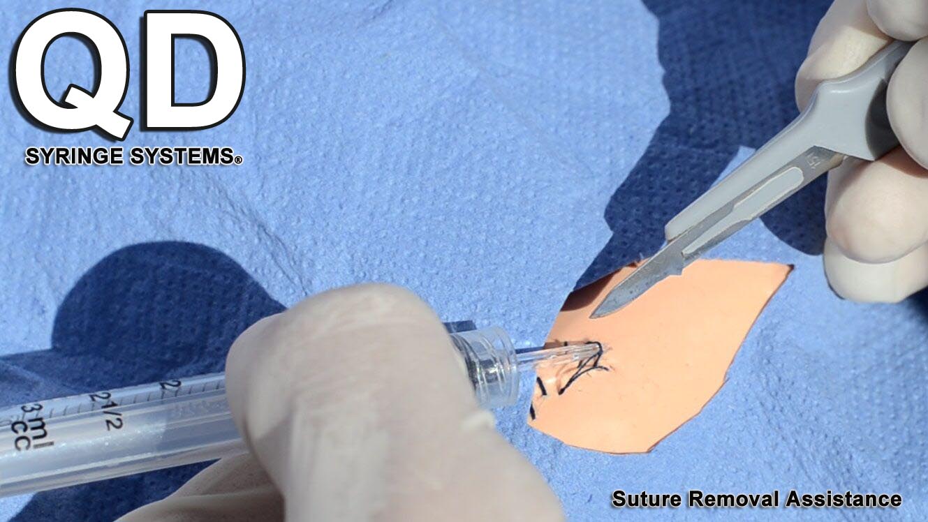 qd-syringe-suture-removal-assistance
